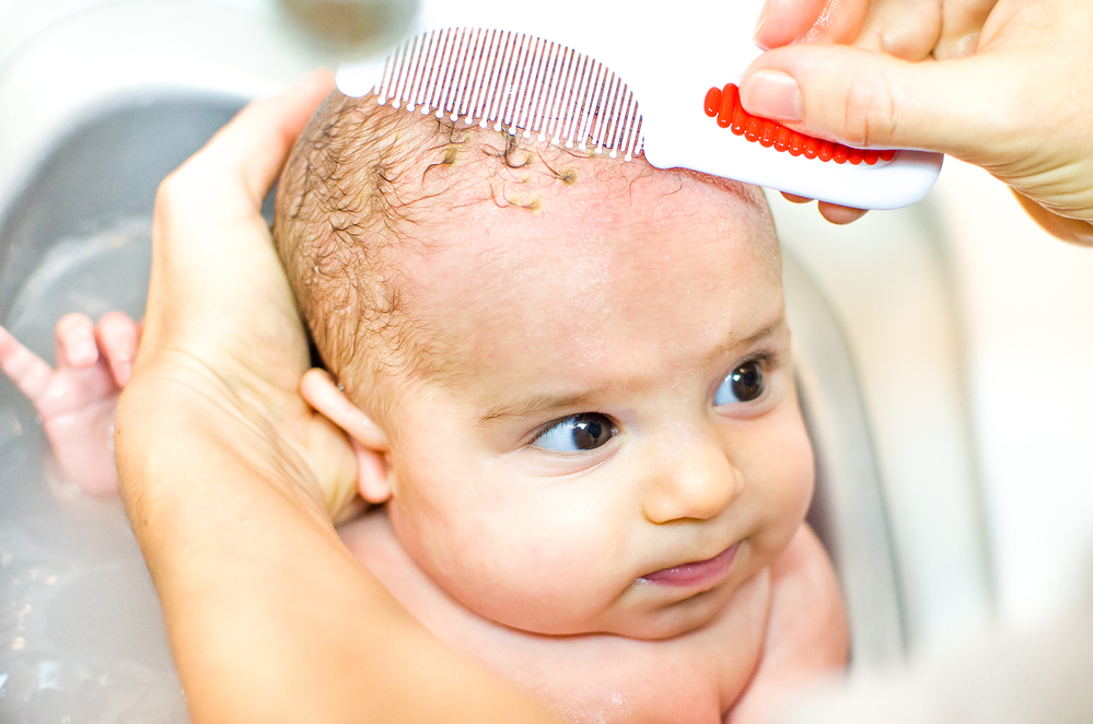 best baby wash for cradle cap